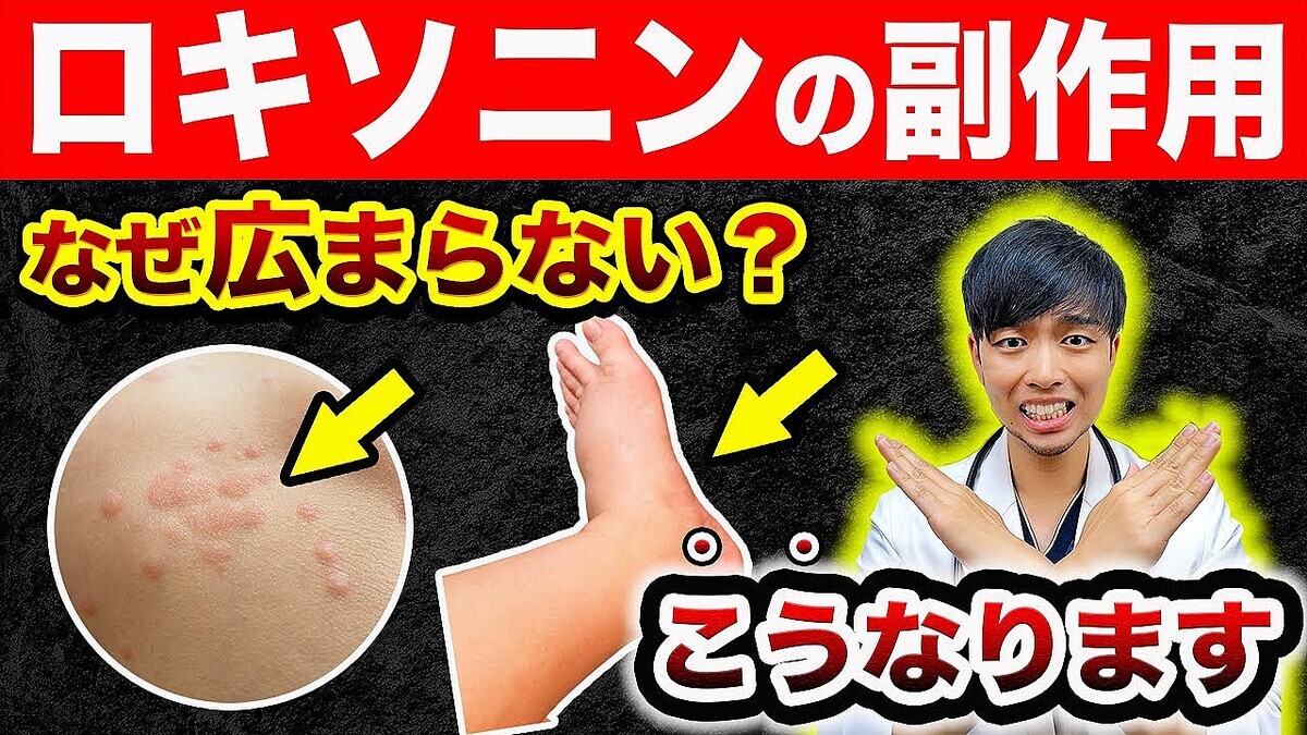 ��­�Τय�ߤ������Ѥ��ä��׸����դ��������������������˥�δ������ȸ����դ��礤��