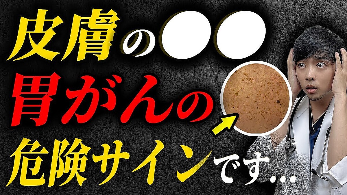 ���ΤäƤ��������װߤ���ΰճ��ʽ���ɾ�������Ρȹ������ܡɤϴ����ʥ�����