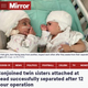���Ƥ��ߤ��򸫤Ĥ�礦�лҤ��֤����ʲ����ϡ�The Mirror��2021ǯ9��6���ա�Conjoined twin sisters attached at head successfully separated after 12 hour operation�ס�Image: via REUTERS�ˡ٤Υ����꡼�󥷥�åȡ�