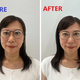 before after