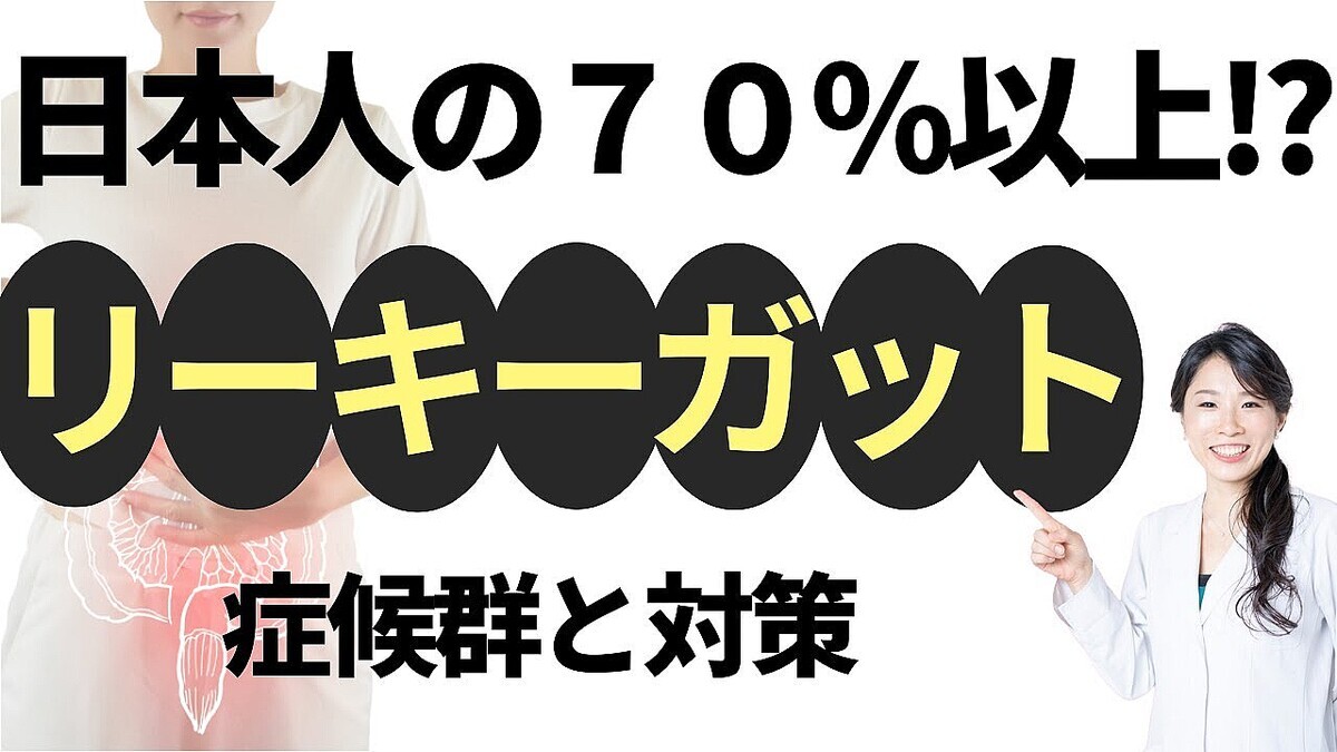 �������ץ饯��ー��ú������ԥ���®︎���Ҳ�ͼ���һ᤬�������ܿͤ�¿�������Ť���������ー��ー���åȾɸ����פؤΥ���ե������