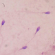 20260430_sperm