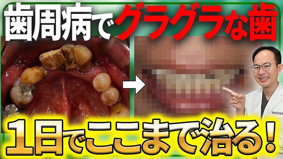 �֤⤦���٤줫��פ������ΤϤޤ��ᤤ�����ʰ夬���⤹�륤��ץ��ȼ��Ťη�Ū�Ѳ�