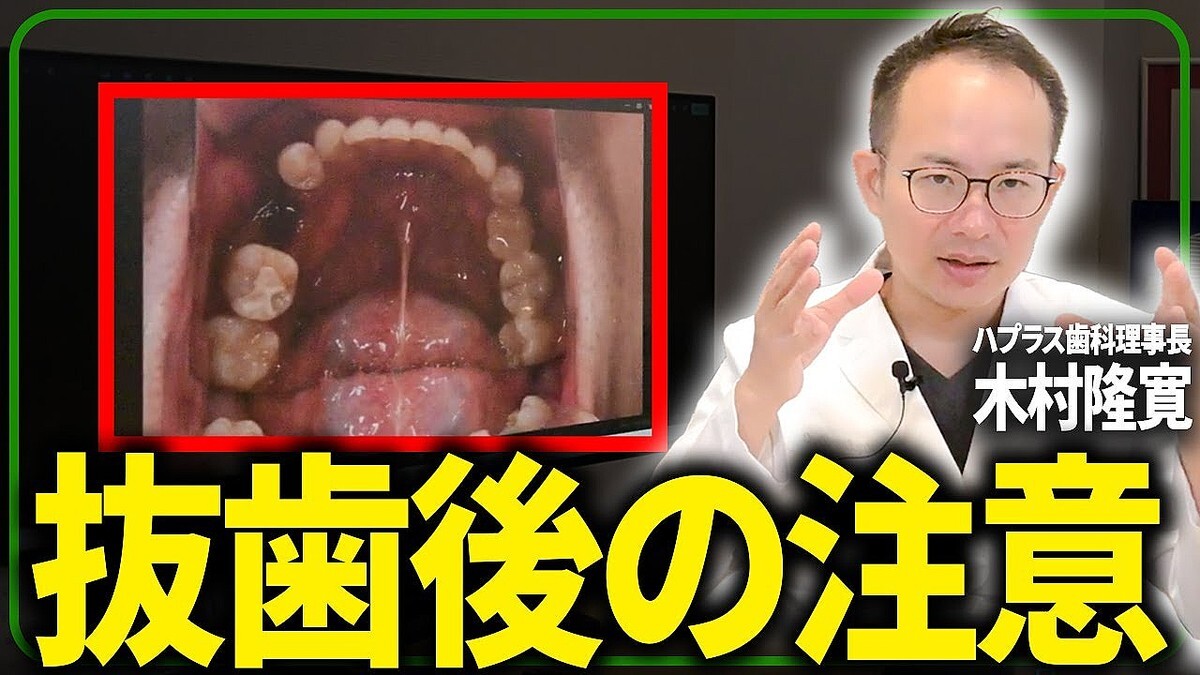 ���ʰ夬�����ȴ�������������Ϥʤ����ᡩ ���μ���򺸱����륻��ե�����������