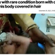 体の60パーセント以上が黒い毛で覆われた新生児（画像は『New York Post　2022年12月29日付「Baby with rare condition born with over half his body covered in hair」（Jam Press Vid/Rare Shot News）』のスクリーンショット）