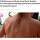 ������Ҥθ��ä��������Ѥ�¿�Ӿɤˡʲ����ϡ�The Amed Post��2020ǯ12��2���ա�Children sprout hair over their bodies after being mistakenly given hair restorer for stomach upset�סʡ�C��NEWSFLASH�ˡ٤Υ����꡼�󥷥�åȡ�