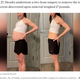 ������ȼ�Ѹ�ν����ʲ����ϡ�ABC News��2021ǯ10��14���ա�Woman who struggled for months with weight gain diagnosed with 17-pound cancerous tumor�ס�Courtesy Amanda Shoultz�ˡ٤Υ����꡼�󥷥�åȡ�