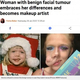 2�ФǴ�˼��礬�Ǥ��Ϥ᤿�����ʲ����ϡ�Metro��2020ǯ1��29���ա�Woman with benign facial tumour embraces her differences and becomes makeup artist�ס�Picture: MDW Features�ˡ٤Υ����꡼�󥷥�åȡ�